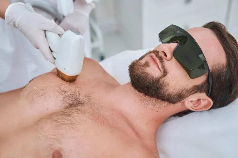 Laserontharing voor mannen